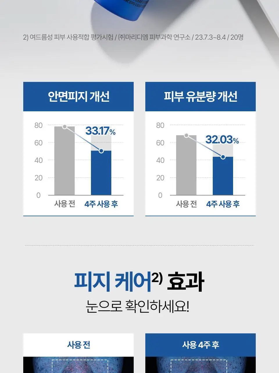 [개기름/속피지] 아이소이 포맨 아크니 닥터 올인원 100ml 기획 (+진정 올인원 15ml) 상세페이지 12